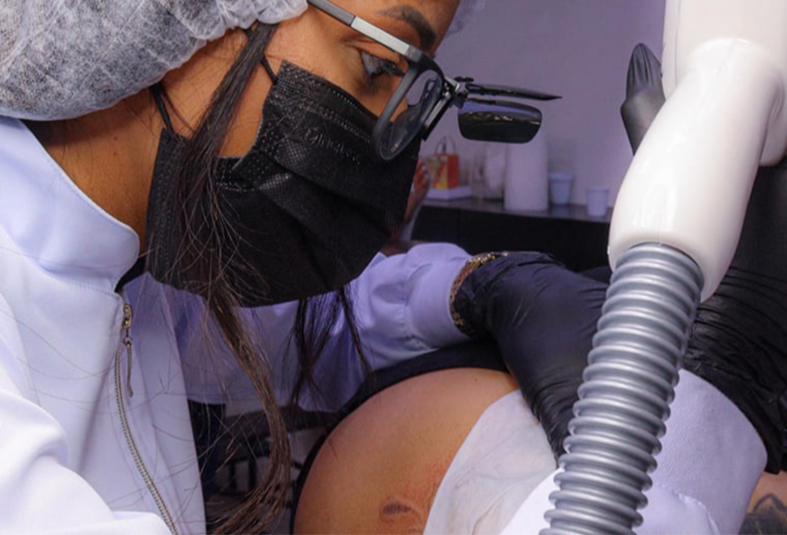 É possível remover totalmente uma tatuagem?